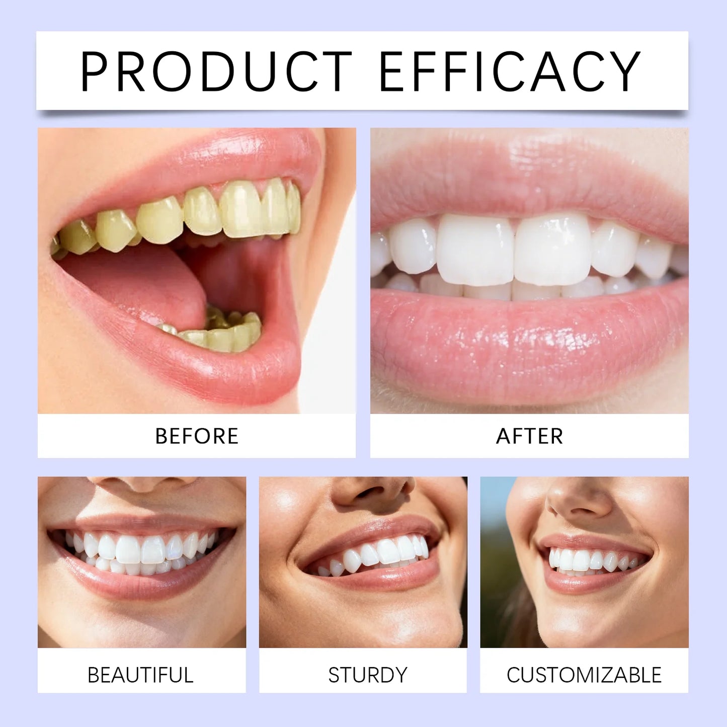 Purple Teeth Whitening Strips — Professional Dental Gel for a Brighter Smile in 3 Days